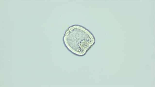 Larva sea urchin Strongylocentrotus pallidus under microscope, phylum Echinodermata. Gastrula stage. White sea