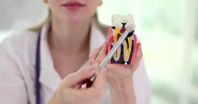 Dentist shows caries on artificial tooth and treatment methods. Dental problem and dental treatment