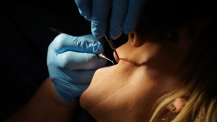 dental treatment. Woman getting her teeth cleaned and having implant treatment