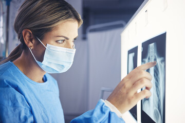 Healthcare, woman and doctor analyzing xray for medical diagnosis on a screen in the hospital....