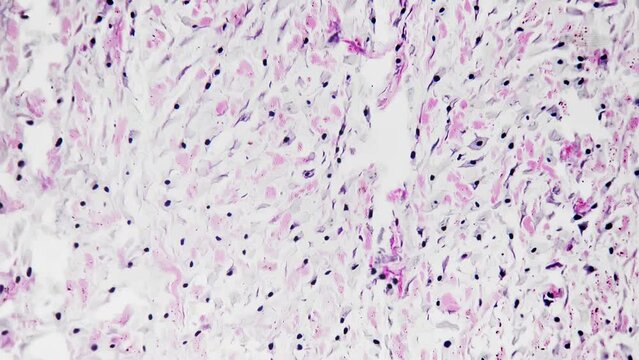 White fibrous tissue of human being filmed under microscope 200x on bright field background. Isolated macro of dense regular connective layers consisting of fibroblasts and having strong structure.
