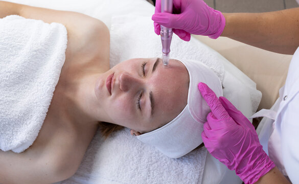 Top View Cosmetologist Doing Mesotherapy Injection With Dermapen On Face Of Young Woman For Rejuvenation In Spa Center. Patient Getting Needle Mesotherapy, Skincare. Horizontal Plane