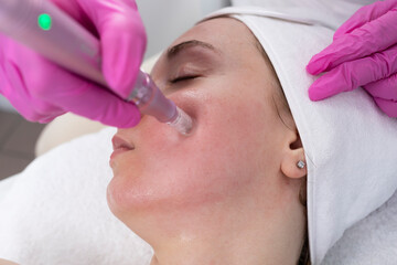 Closeup Cosmetologist Making Mesotherapy Injection With Dermapen On Face, Cheek Area Of Young Woman For Rejuvenation In Spa Center. Patient Getting Needle Mesotherapy, Skincare. Horizontal Plane - obrazy, fototapety, plakaty