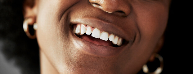 Dental, beauty and teeth with closeup of person for medical, cosmetics and oral hygiene. Health,...
