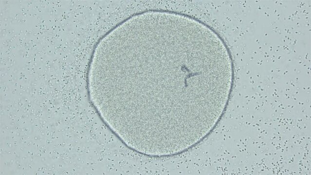 Sperm and ovule sea urchin Strongylocentrotus pallidus under microscope, phylum Echinodermata. White sea