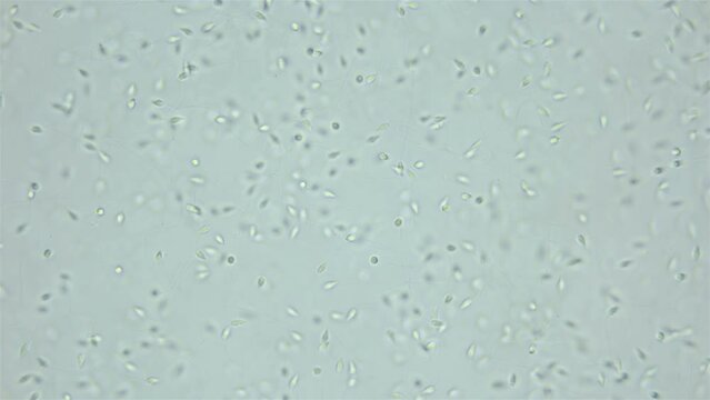 Sperm sea urchin Strongylocentrotus pallidus under microscope, phylum Echinodermata. White sea