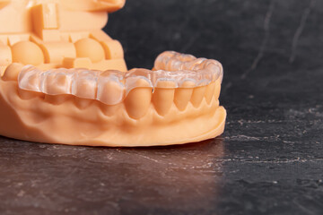 Aligners for teeth alignment on orange plastic jaw model. Lower jaw. Removable orthodontic device on black background - obrazy, fototapety, plakaty