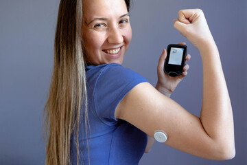 Girl showing her flash glucose monitor with normal blood sugar level - obrazy, fototapety, plakaty