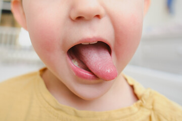 Fototapeta premium The protruding tongue of the child. Baby aged two years (two-year-old boy)