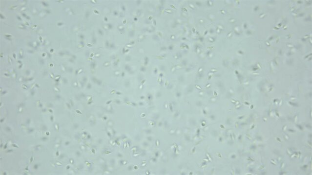 Sperm sea urchin Strongylocentrotus pallidus under microscope, phylum Echinodermata. White sea