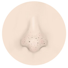 hand-drawn illustration of acne type. whiteheads, inflamed pimples, pores, blackheads, whiteheads, pustules. Art design Skincare concept for banner, makeup, skincare advertising.