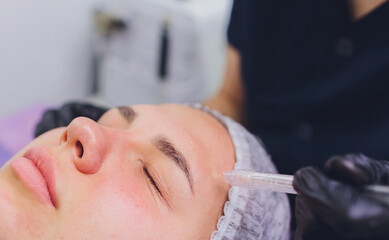 Woman cleaning nose skin pores using vacuum blackhead remover, cosmetic procedure.