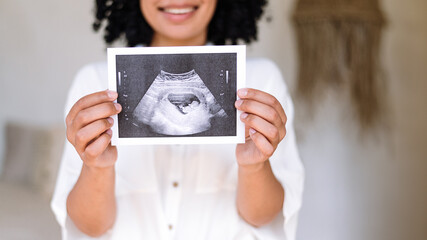 Happy woman holding in hands sonography photo of baby - Powered by Adobe