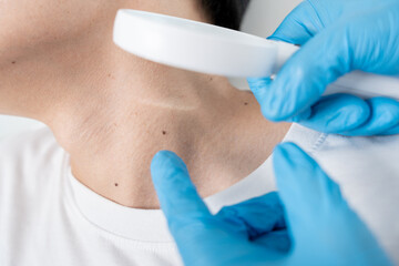 Fototapeta premium skin problem of asian man. Dermatologist use magnifying glass look itchy skin from skin allergic, steroid allergy, sensitive skin, chemical allergy, rash, insect bites, Dermatitis.