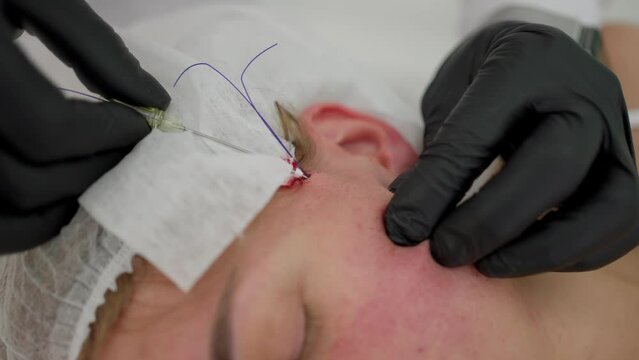 A cosmetologist performs a cheekbone lift on the face