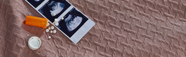 top view of bottle with pills, ultrasound, unborn baby, birth control, abortion concept, banner
