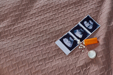 top view of bottle with pills, ultrasound, unborn baby, birth control, bedroom, abortion concept