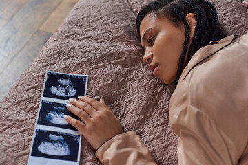 top view of worried african american woman lying on bed near ultrasound,  abortion concept
