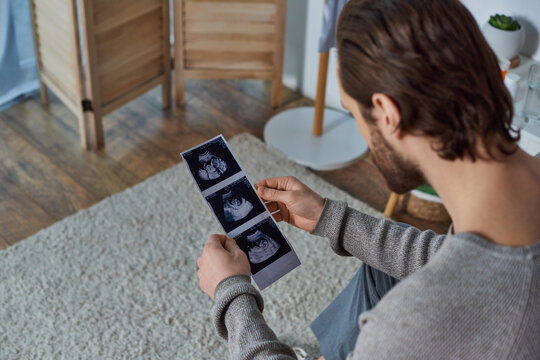 bearded man holding ultrasound photo, sitting on bed, pregnancy, responsibility, future father