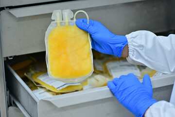 Close-up view of yellow plasma bag It is a liquid that separates from the blood. Medical concept,...