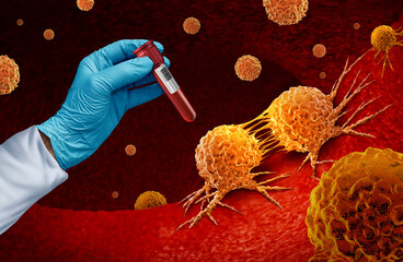 Cancer blood test and Multi malignant disease screening for early detection of cancers and cancerous tumor cells as genetics and immunotherapy or chemotherapy oncology 