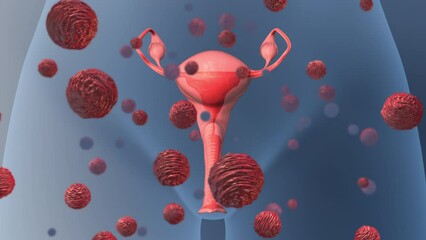 Infected ovaries in the female reproductive system