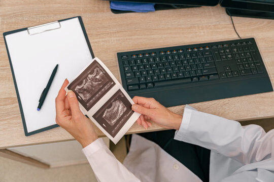 Woman doctor holds results of ultrasound examination in her hands in hospital. High quality photo