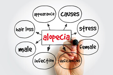 Alopecia mind map, medical concept for presentations and reports