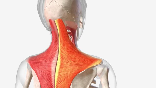 Trapezius myalgia (TM) is the complaint of pain, stiffness, and tightness of the upper trapezius muscle