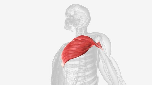 A pectoralis major strain refers to a tear in the large muscle which covers the chest