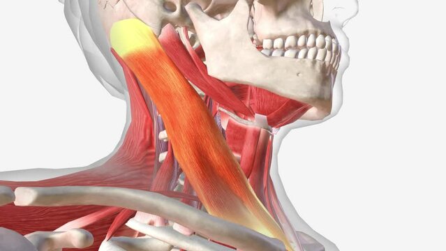 Sternocleidomastoid is the most superficial and largest muscle in the front portion of the neck