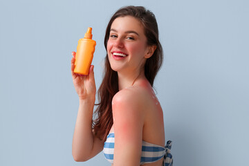 Allergic young woman with sunburned skin and cream on blue background