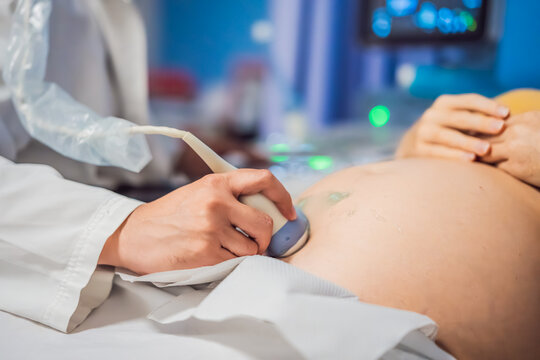 In the Hospital, Close-up Shot of the Doctor does Ultrasound Sonogram Procedure to a Pregnant Woman. Obstetrician Moving Transducer on the Belly of the Future Mother