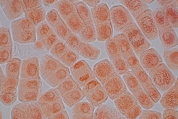 Mitosis cell in the Root tip of Onion under a microscope.	