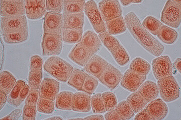 Mitosis cell in the Root tip of Onion under a microscope.	