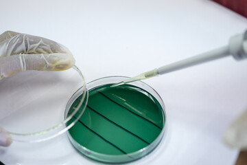 Analysis of bacteria in shrimp in the laboratory.