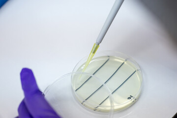 Analysis of bacteria in shrimp in the laboratory.