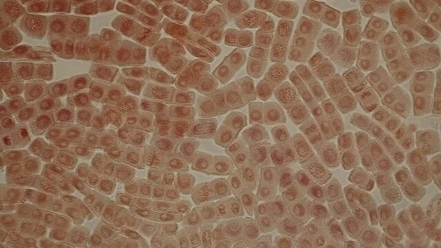 Mitosis cell in the Root tip of Onion under a microscope.