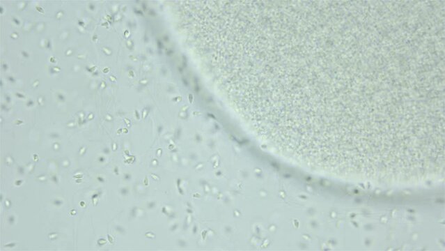 Sperm and ovule sea urchin Strongylocentrotus pallidus under microscope, phylum Echinodermata. White sea