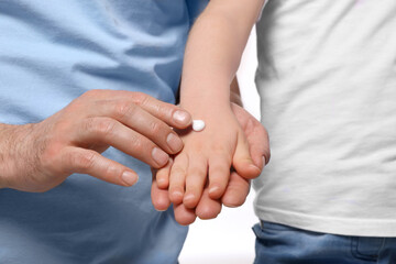 Father applying ointment onto his daughter's hand against white background, closeup