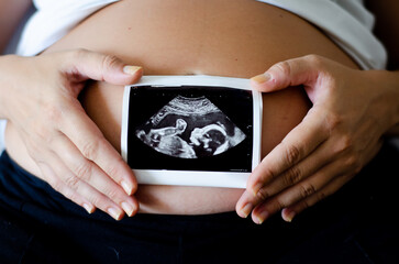 Pregnant woman holding an ultrasound image of the baby. Close-up of pregnant belly and ultrasound photography in mother's hands. Untied and healthy pregnancy concept