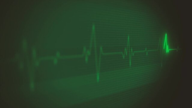 Medical Heart Pulsation Wave Signal/ 4k animation of a health technology background with red sine wave of heart pulsation signal