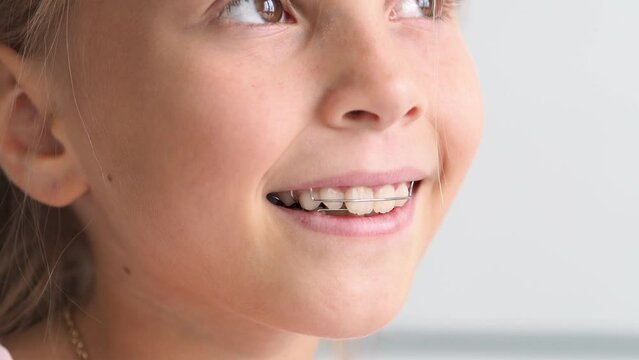 Children's teeth large with a cap. Bracket system on the teeth. Alignment of teeth with a dental plate. Malocclusion in a child. Crooked teeth. The concept of pediatric dentistry.