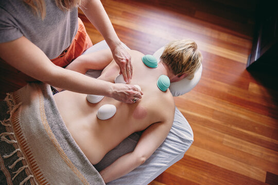 Female therapist doing a cupping treatment