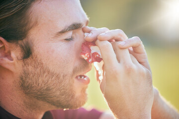 Nose bleed, man and injury closeup on sport field with emergency, accident and blood outdoor. Swollen, broken and male athlete with medical and bruise after pain, game workout and exercise training