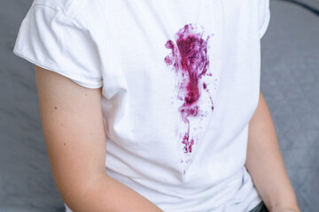 A dirty stain from berries on a child's white clothes. Daily life dirty stain and cleaning concept.