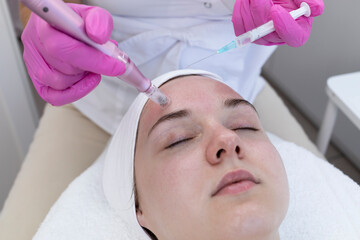 Cosmetologist Applying Peeling For Mesotherapy Injection With Dermapen On Face, Forehead Area Of Young Woman For Rejuvenation In Spa Saloon. Patient Getting Needle Mesotherapy, Skincare. Horizontal. - obrazy, fototapety, plakaty