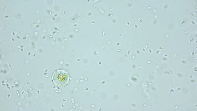 Sperm of Worm Polychaeta Nereis virens (Alitta virens) under microscope, family Nereididae. White Sea