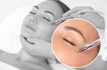 Cosmetologist makes  procedure microdermabrasion on the face against acne and blackheads near the eyes. Women's cosmetology in the beauty salon.