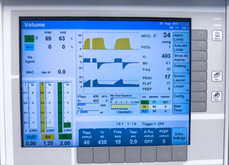 Hospital monitor symbolizes vital signs: heart rate, blood pressure, oxygen levels, temperature, ensuring patient well-being and medical care